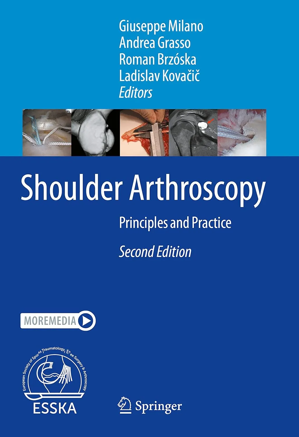 Shoulder Arthroscopy Principles And Practice 2nd Edition | Hardcover