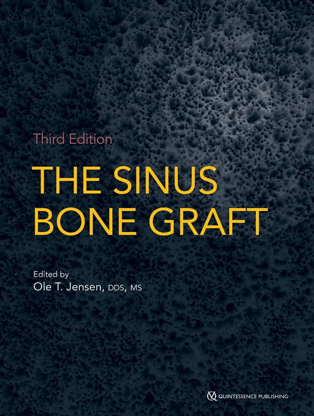 The Sinus Bone Graft | Third Edition | Hardcover