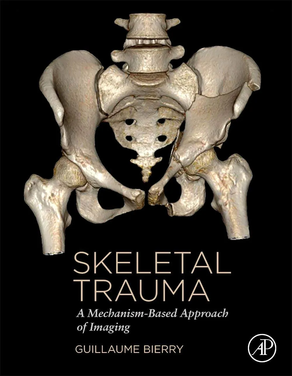 Skeletal Trauma A Mechanism Based Approach Of Imaging | Hardcover