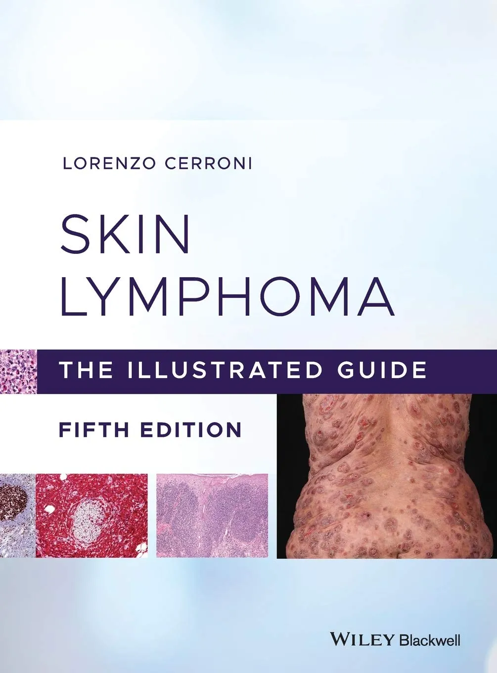 Skin Lymphoma The Illustrated Guide 5th Edition | Hardcover