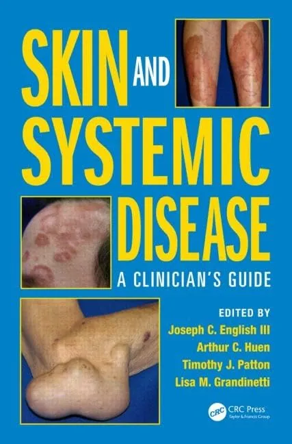 Skin and Systemic Disease A Clinician's Guide | Hardcover