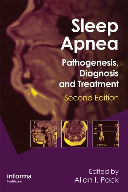 Sleep Apnea Pathogenesis | Diagnosis and Treatment | 2nd Edition | Hardcover
