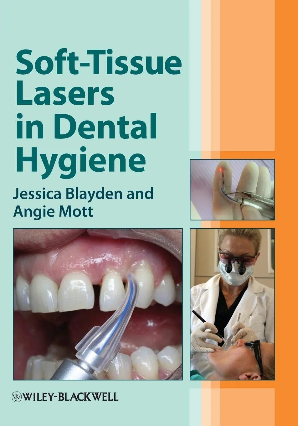 Soft-Tissue Lasers in Dental Hygiene | Paperback