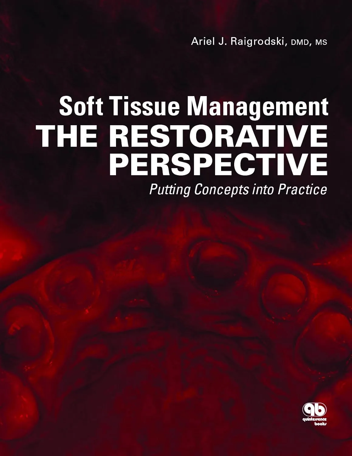 Soft Tissue Management The Restorative Perspective | Hardcover