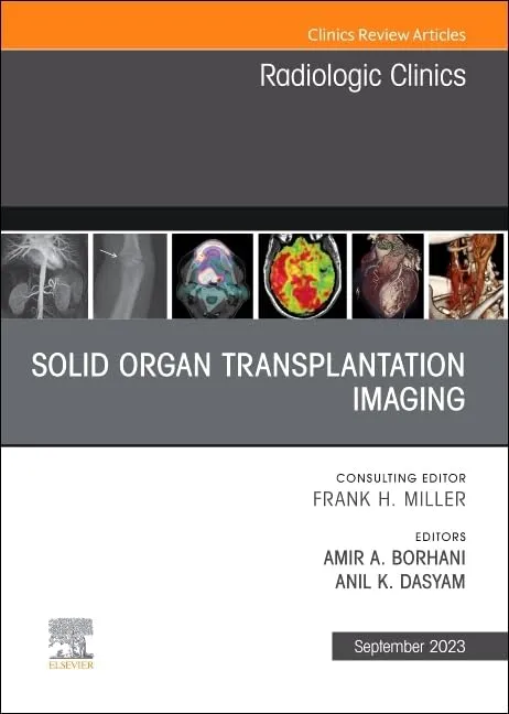 Solid Organ Transplantation Imaging An Issue Of Radiologic Clinics Of North America | Hardcover