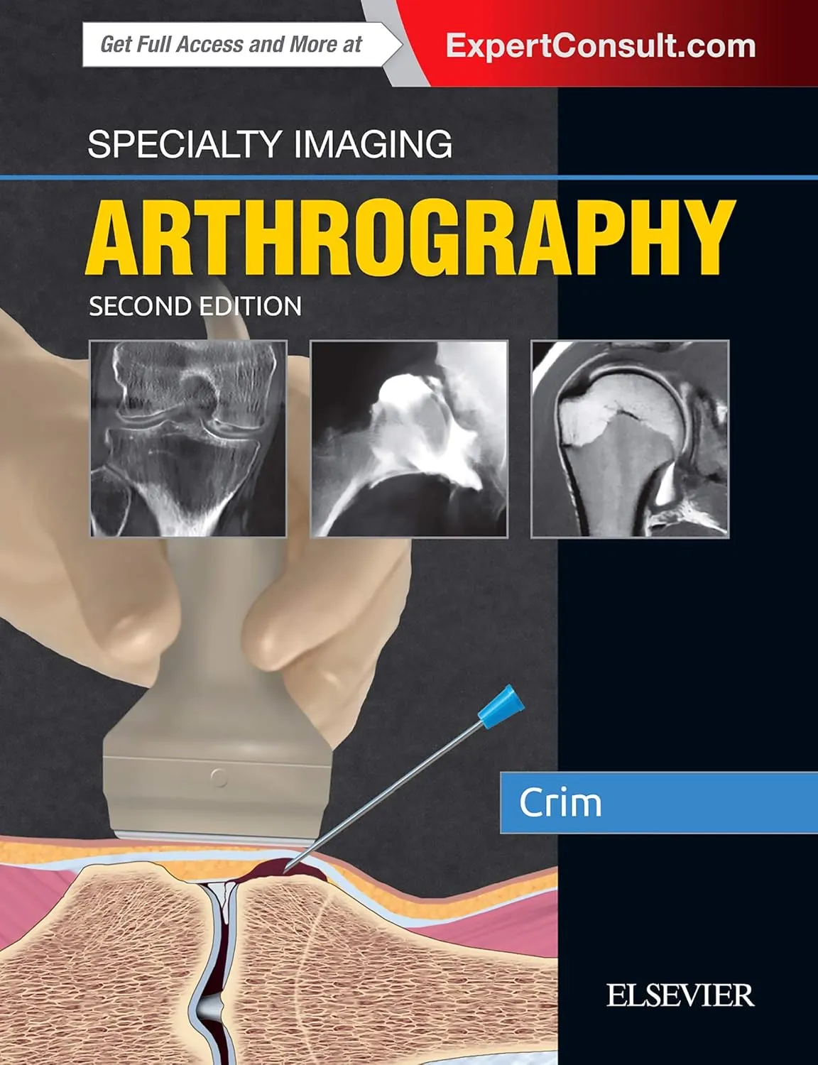Specialty Imaging Arthrography | 2nd Edition | Hardcover