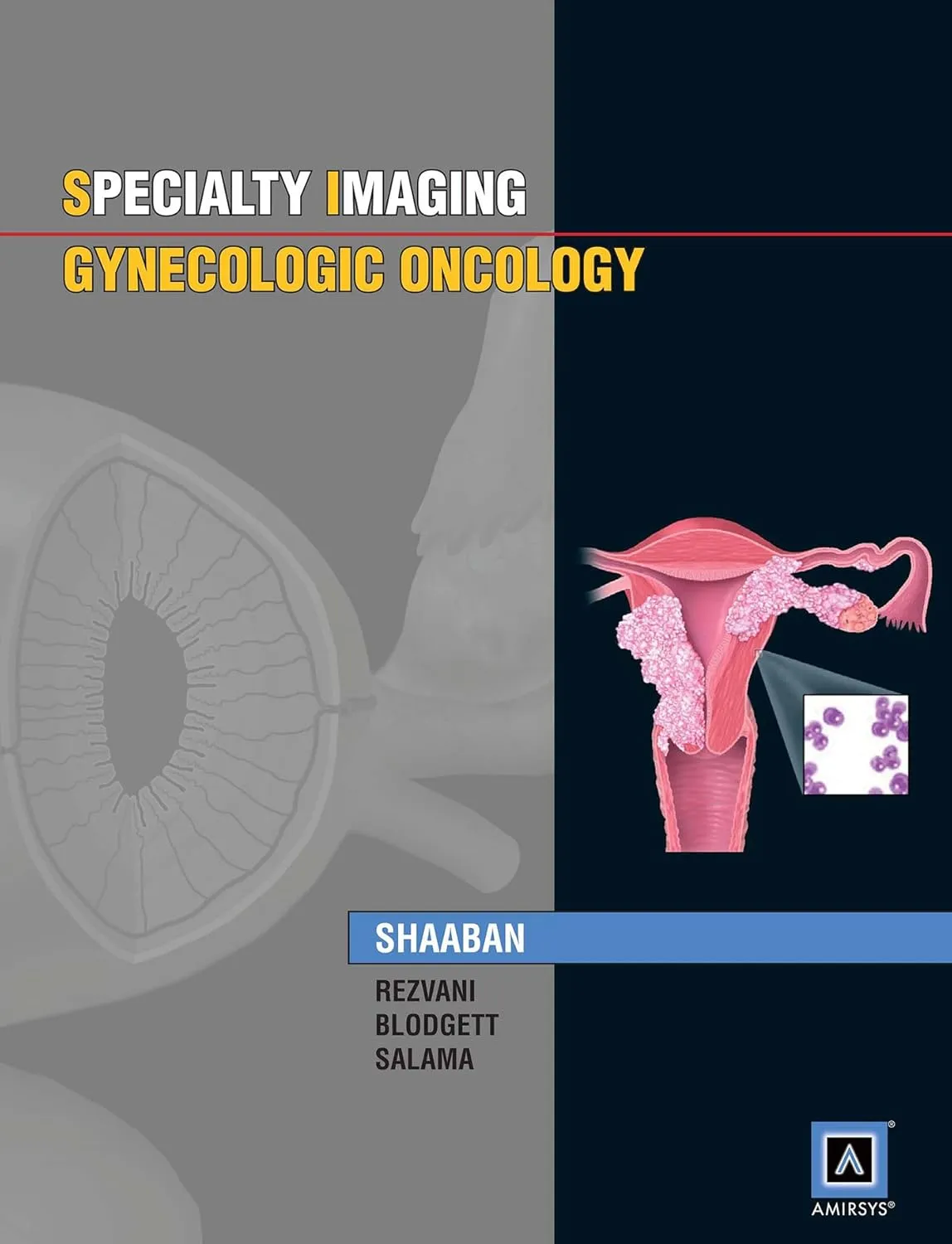 Specialty Imaging Gynecologic Oncology | Hardcover