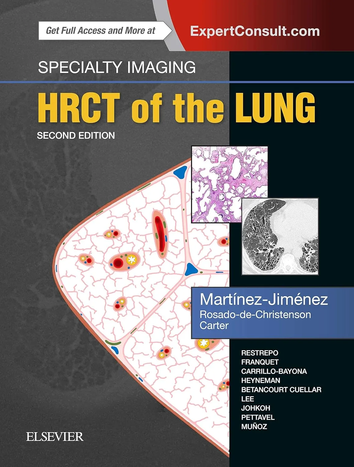 Specialty Imaging HRCT of the Lung | 2nd Edition | Hardcover