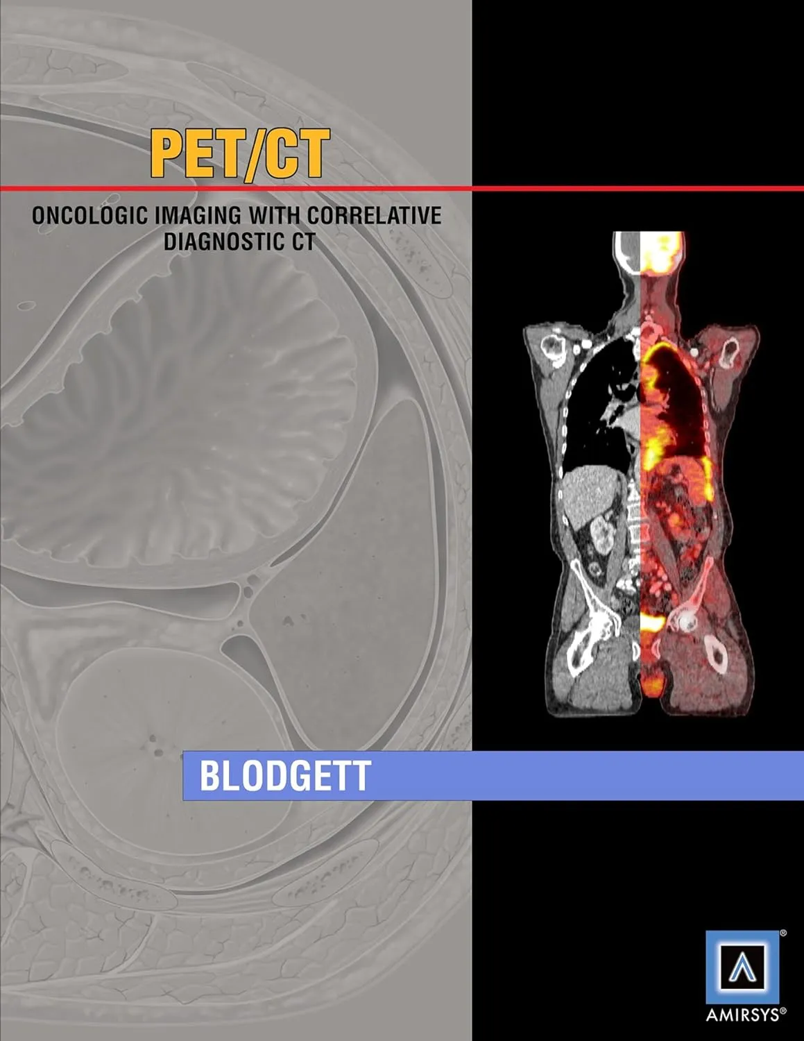 Specialty Imaging PET / CT Oncologic Imaging with Correlative Diagnostic CT | Hardcover