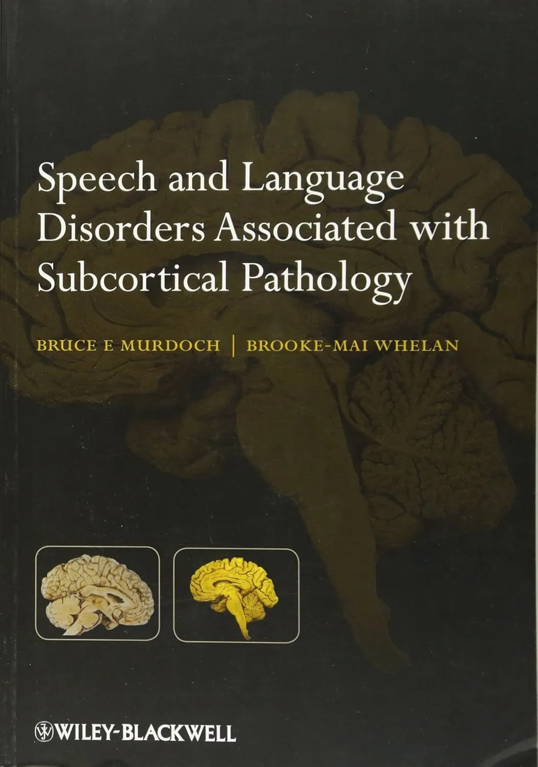 Speech and Language Disorders Associated with Subcortical Pathology | Paperback
