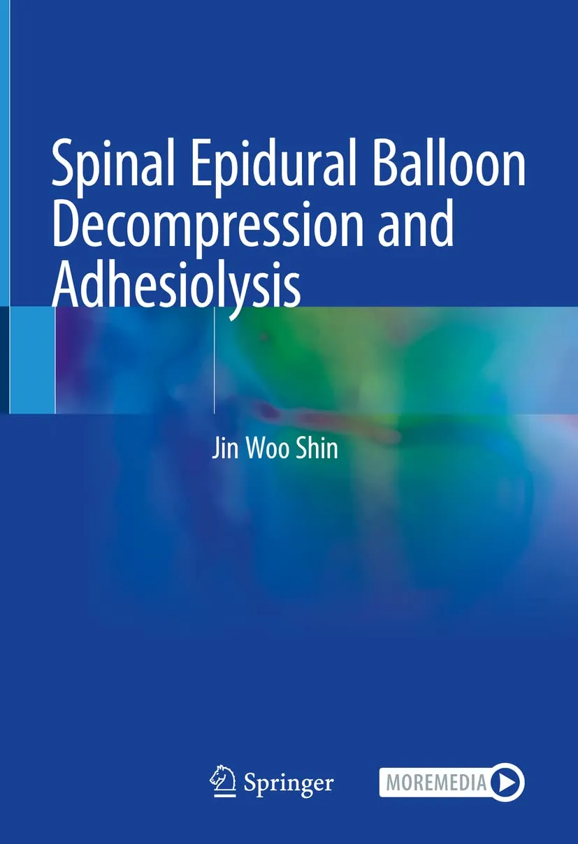 Spinal Epidural Balloon Decompression And Adhesiolysis | Hardcover