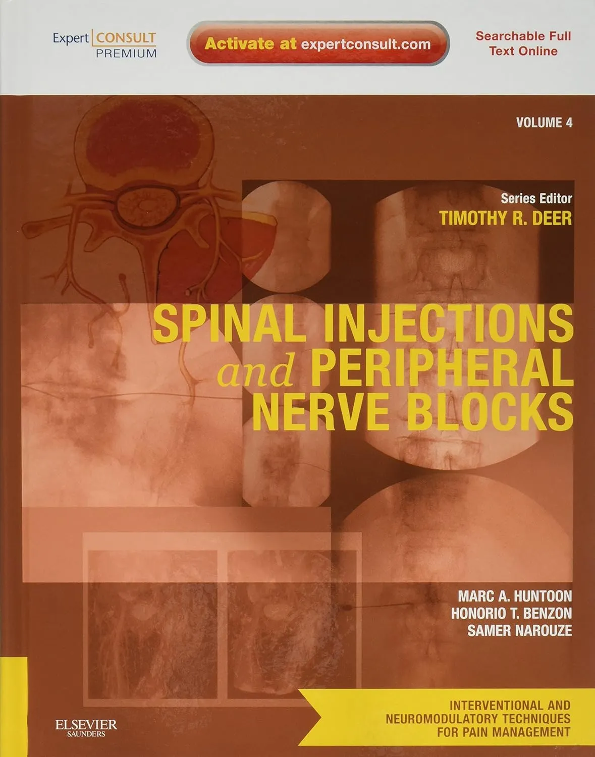 Spinal Injectlions and Peripheral Nerve Blocks | Volume 4 | Hardcover