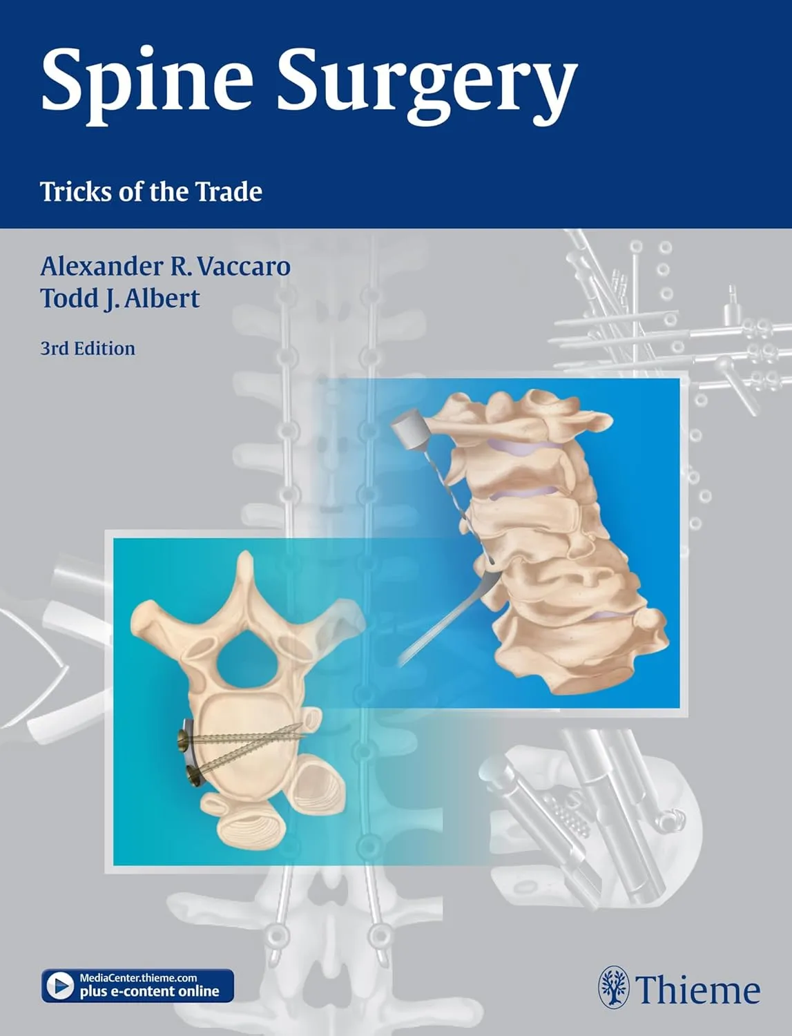 Spine Surgery Tricks of the Trade | Third Edition | Hardcover