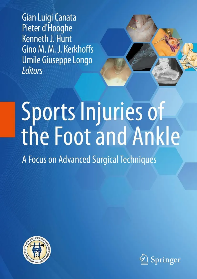 Sports Injuries of the Foot and Ankle | Hardcover