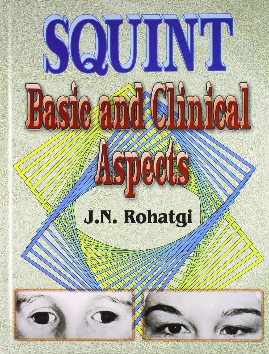 Squint Basic and Clinical Aspects