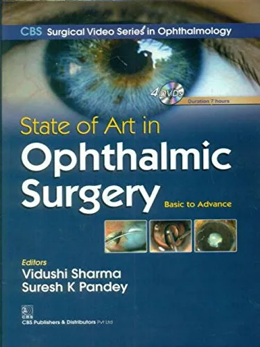 State of Art in Ophthalmic Surgery | With DVD | Hardcover