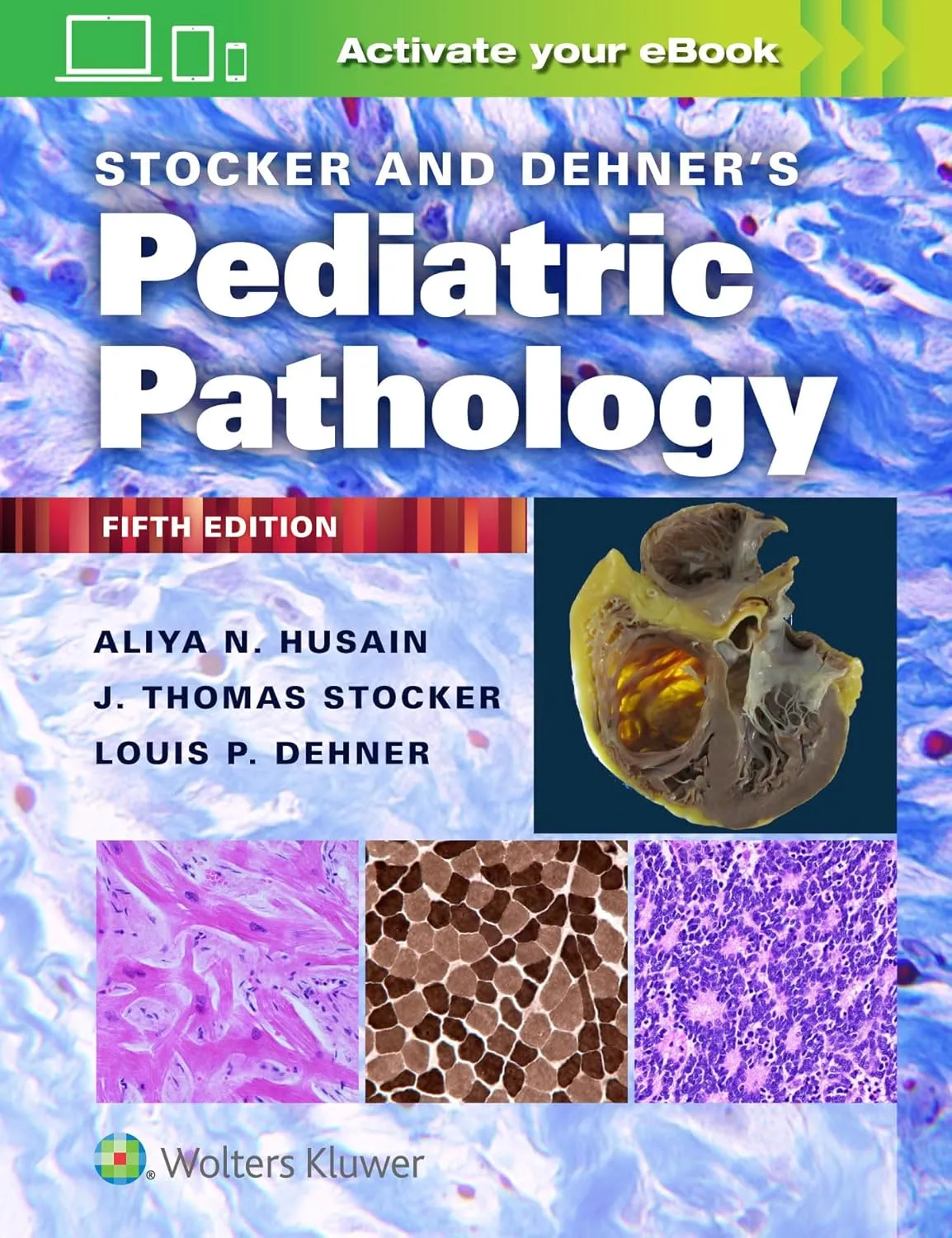 Stocker And Dehners Pediatric Pathology | 5th Edition | Hardcover