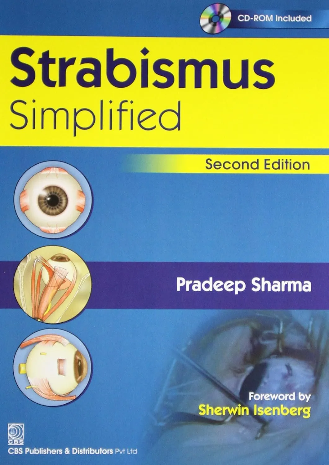 Strabismus Simplified | 2nd Edition | With CD | Paperback
