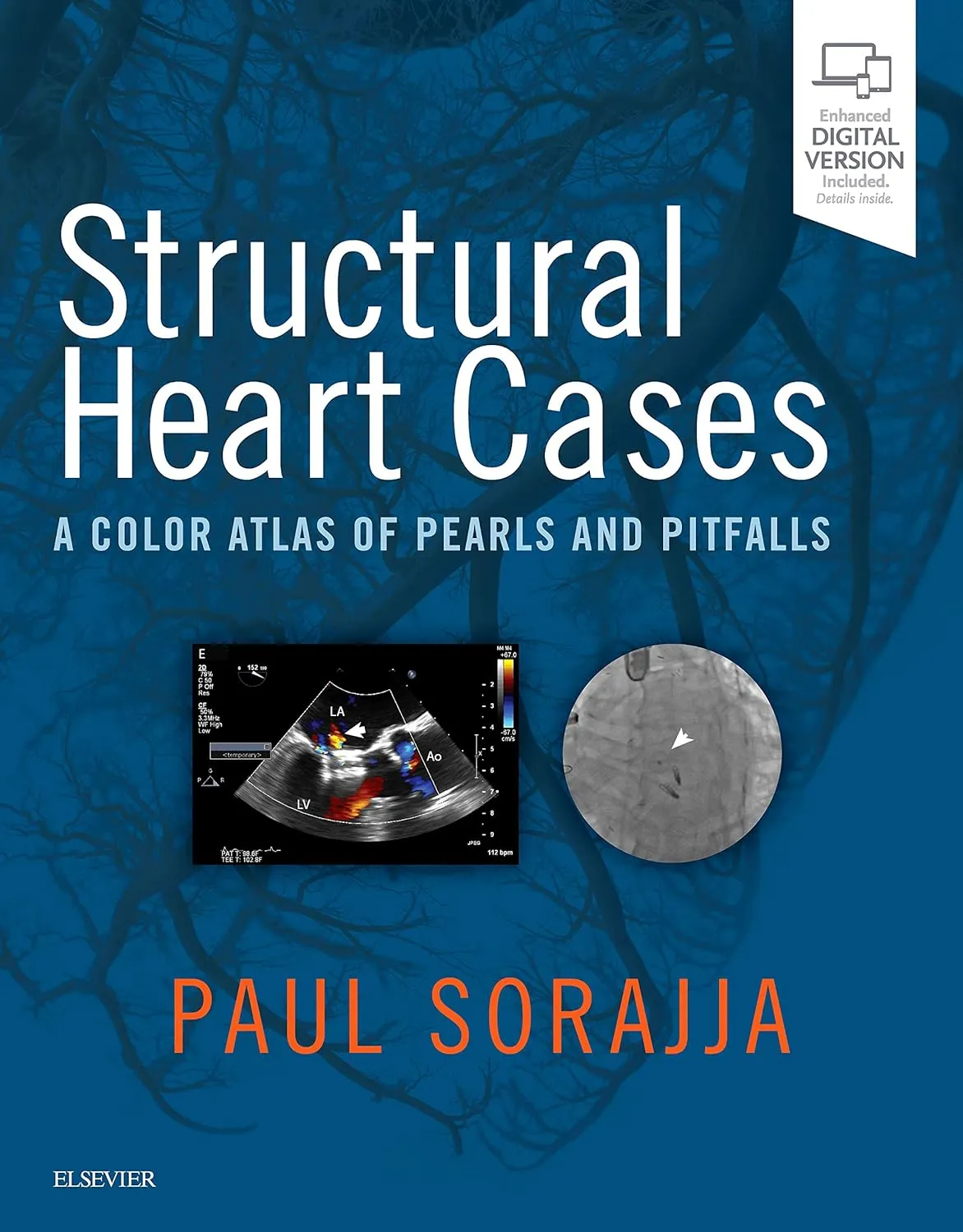 Structural Heart Cases A Color Atlas of Pearls and Pitfalls | Hardcover