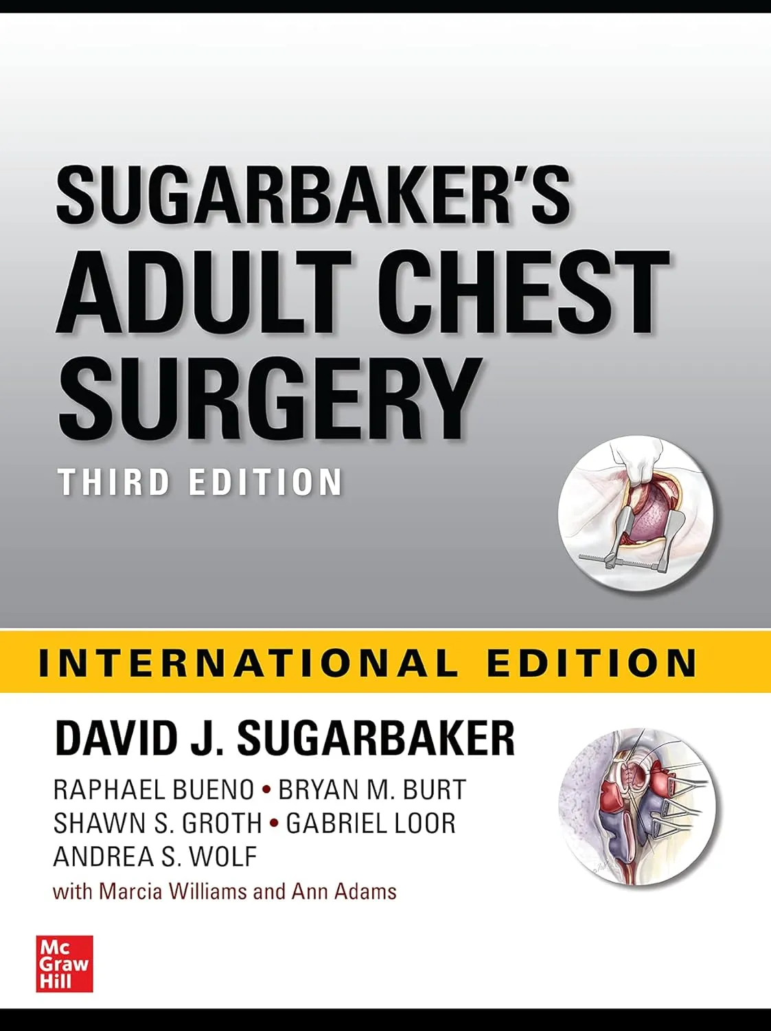 Sugarbakers Adult Chest Surgery Third Edition (Ie) | Hardcover