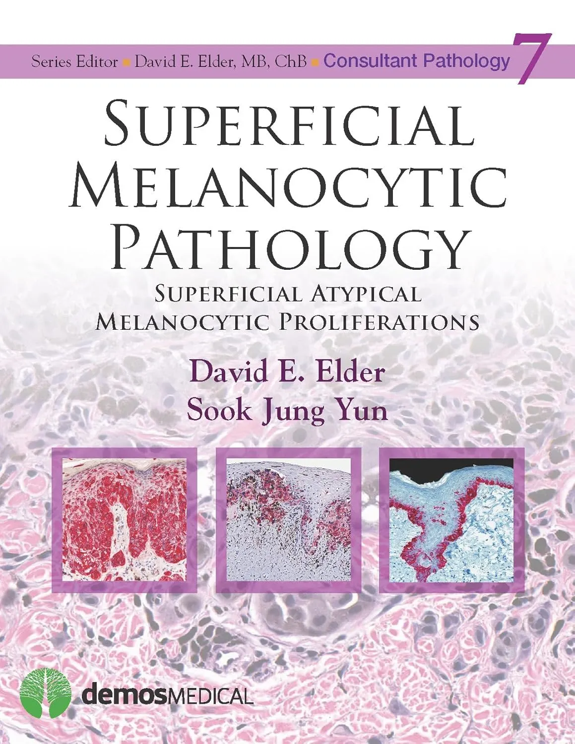 Superficial Melanocytic Pathology | Hardcover