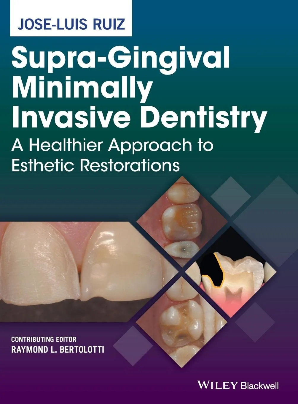 Supra-Gingival Minimally Invasive Dentistry | Hardcover