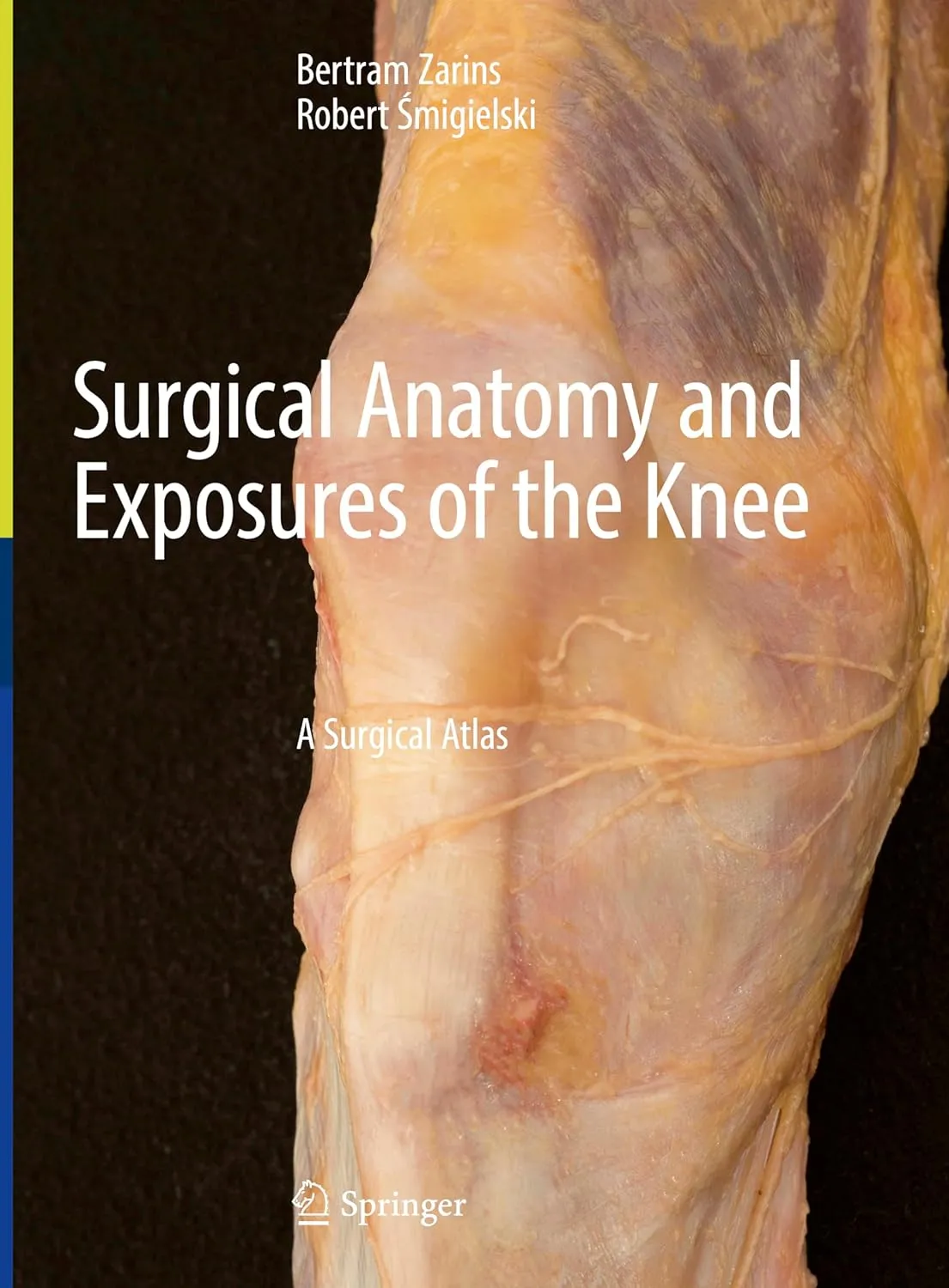 Surgical Anatomy and Exposures of The Knee A Surgical Atlas | Hardcover