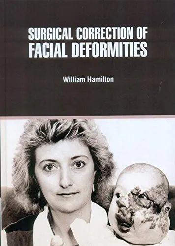 Surgical Correction of Facial Deformities | Hardcover