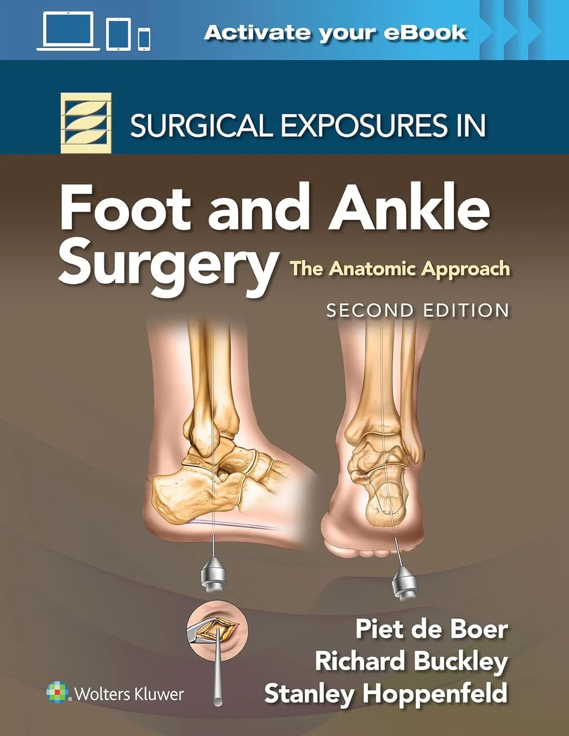 Surgical Exposures In Foot And Ankle Surgery The Anatomic Approach With Access Code 2nd Edition | Hardcover