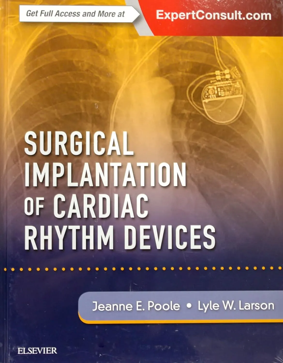 Surgical Implantation of Cardiac Rhythm Devices | Hardcover