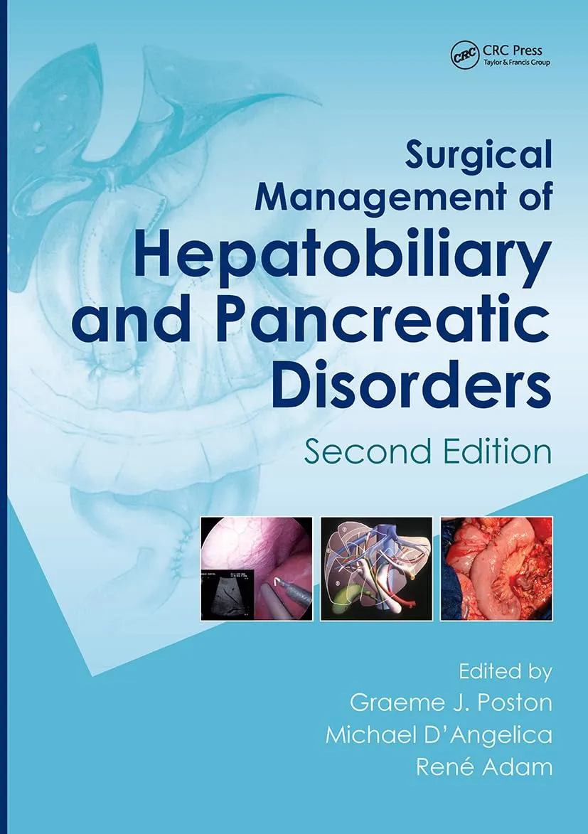 Surgical Management of Hepatobiliary and Pancreatic Disorders | 2nd Edition | Hardcover