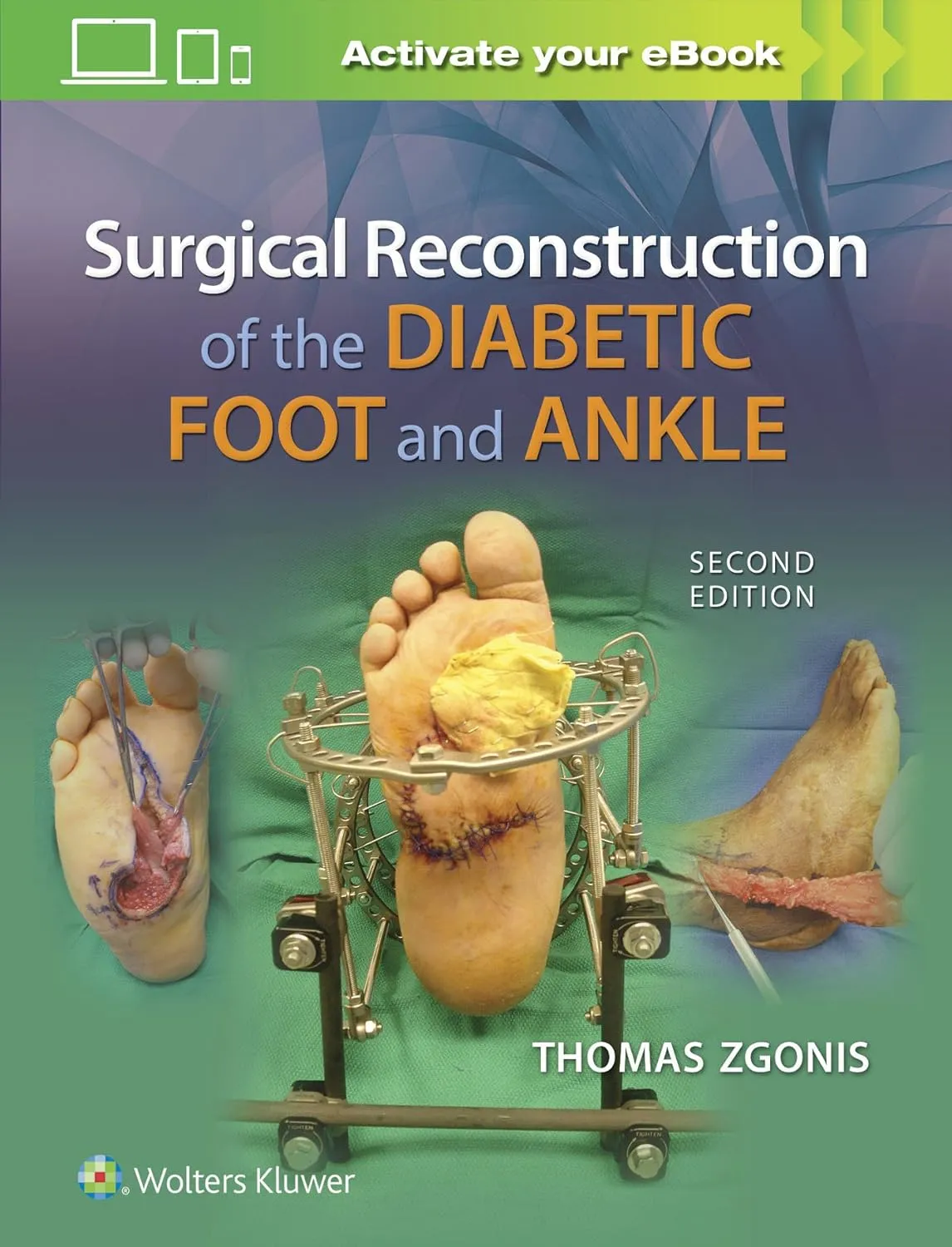 Surgical Reconstruction of the Diabetic Foot and Ankle | 2nd Edition | Hardcover