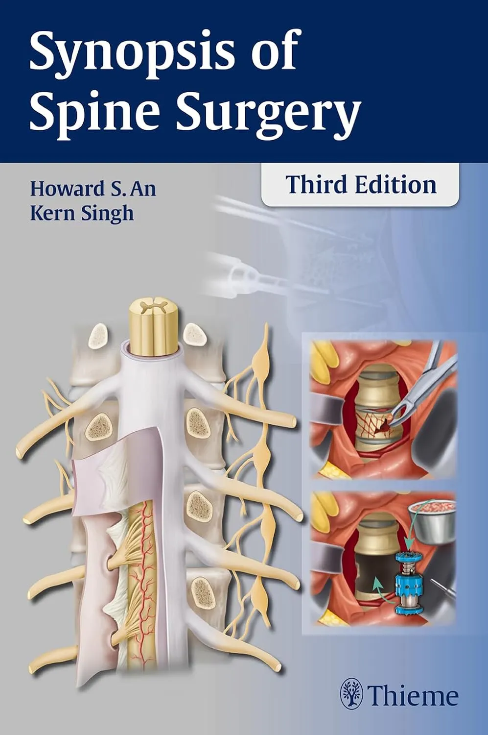 Synopsis of Spine Surgery | Third Edition | Paperback