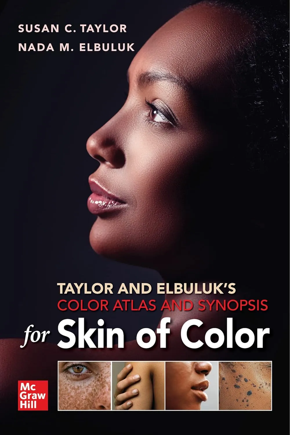 Taylor And Elbuluks Color Atlas And Synopsis For Skin Of Color | Paperback