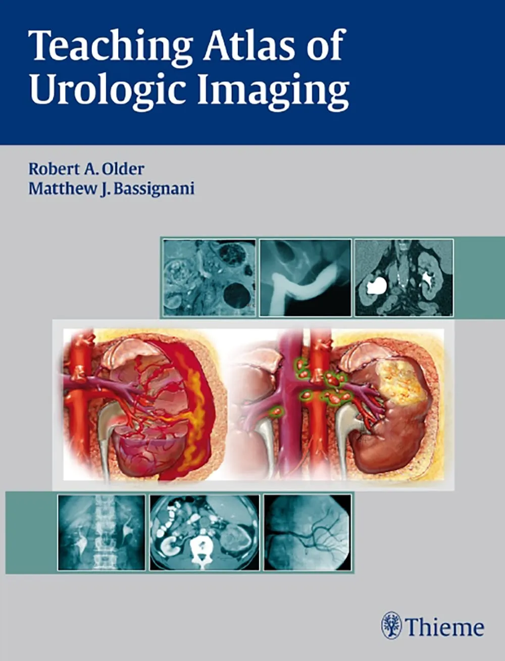 Teaching Atlas of Urologic Imaging | Hardcover