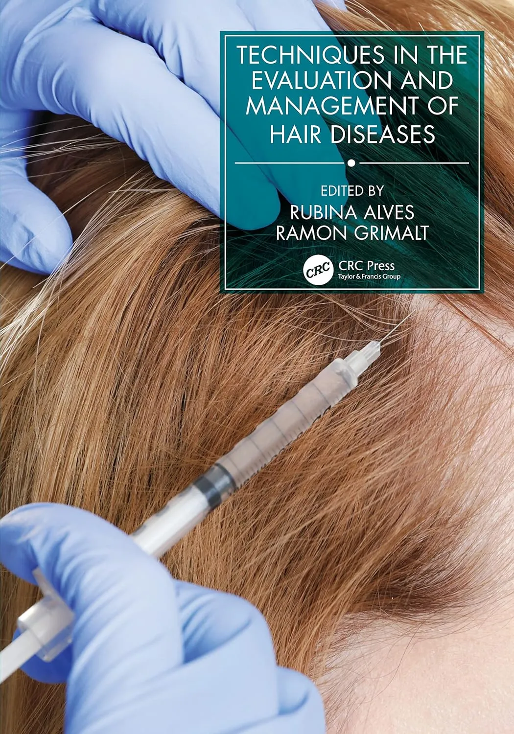 Techniques In The Evaluation And Management Of Hair Diseases | Paperback