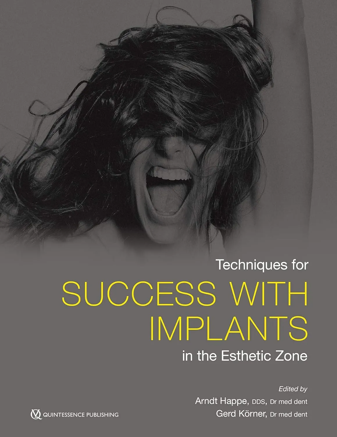 Techniques for Success with Implants in the Esthetic Zone | Hardcover