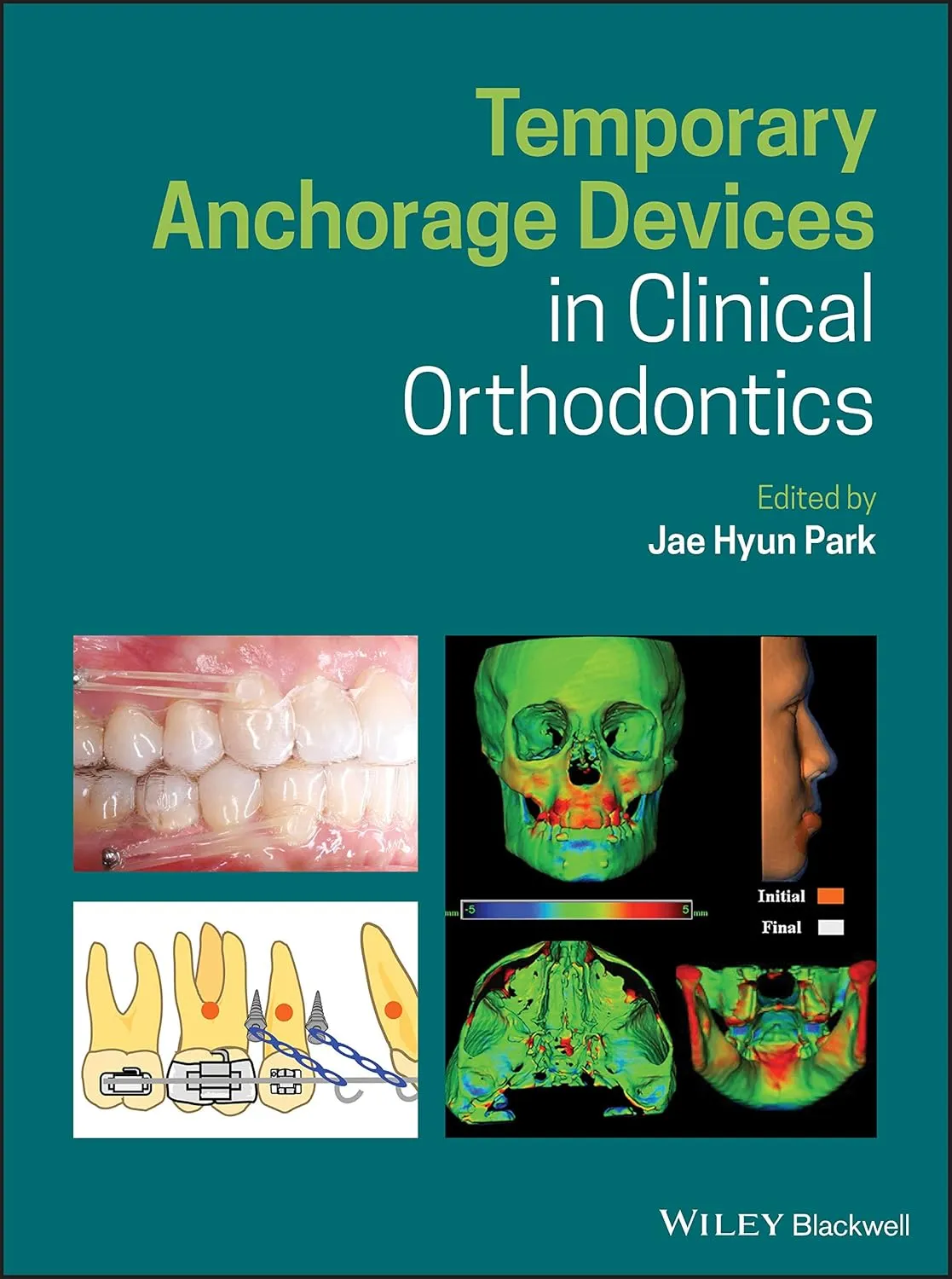 Temporary Anchorage Devices In Clinical Orthodontics | Hardcover