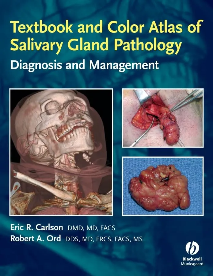 Textbook and Color Atlas of Salivary Gland Pathology Diagnosis and Management | Hardcover
