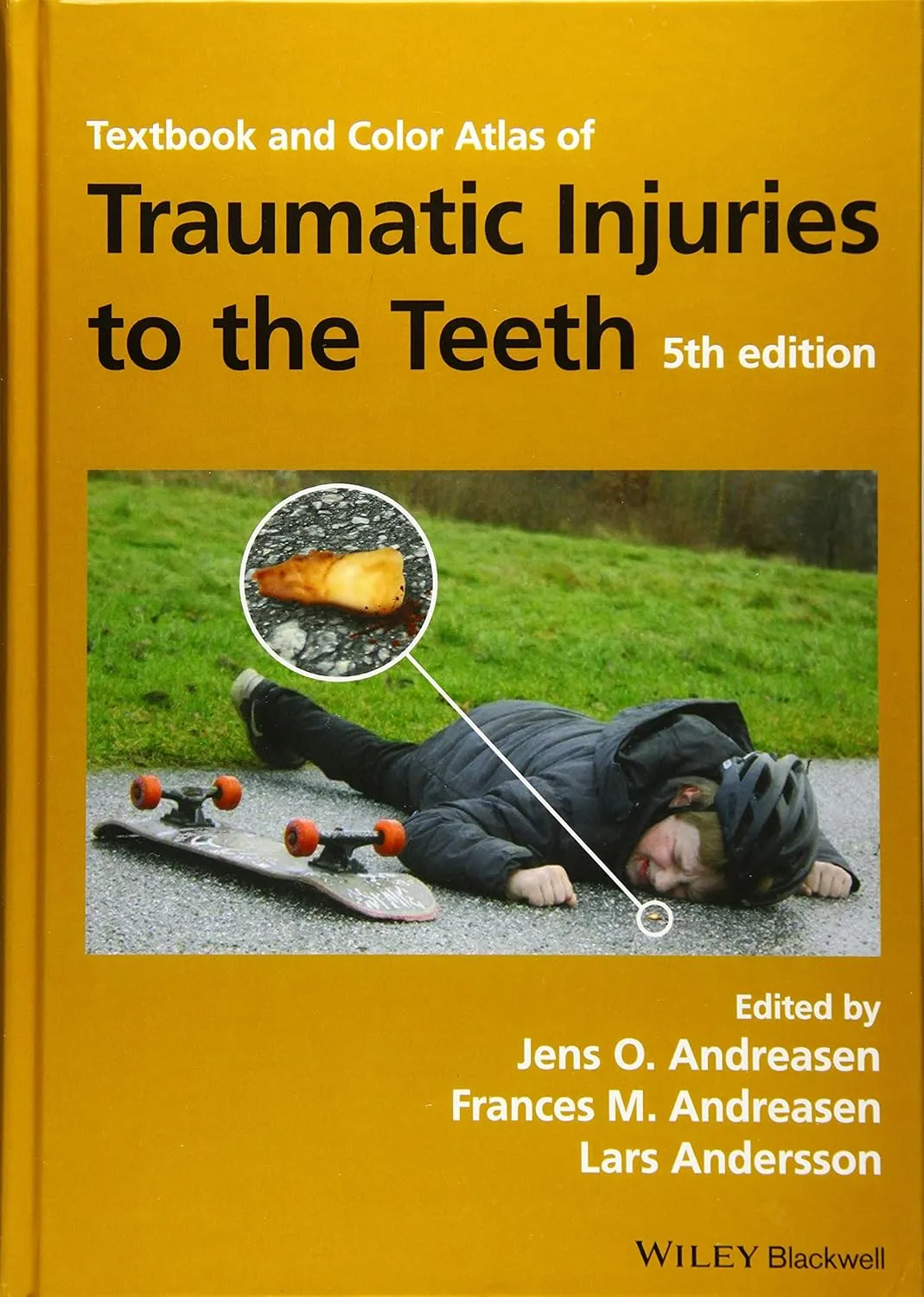 Textbook and Color Atlas of Traumatic Injuries to the Teeth | 5th Edition | Hardcover