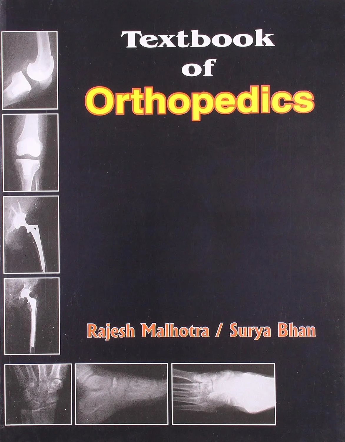 Textbook of Orthopedics