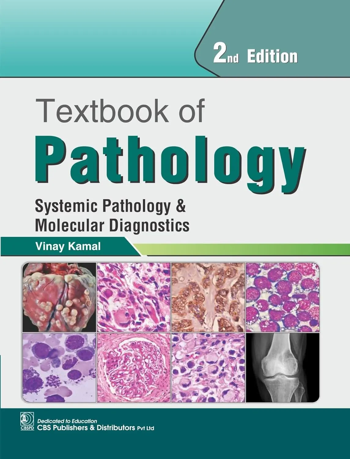 Textbook of Pathology | Systemic Pathology and Molecular Diagnostics | 2nd Edition