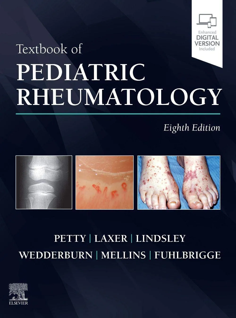 Textbook Of Pediatric Rheumatology 8th Edition | Hardcover