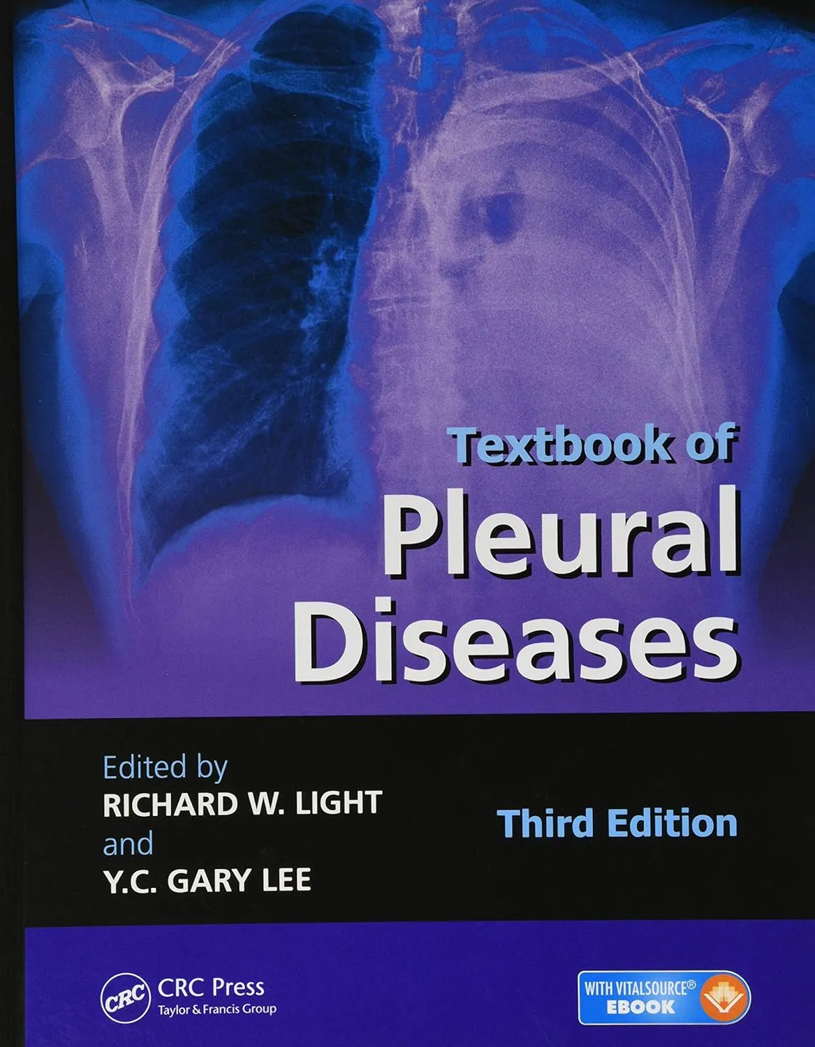 Textbook of Pleural Diseases | Third Edition | Hardcover