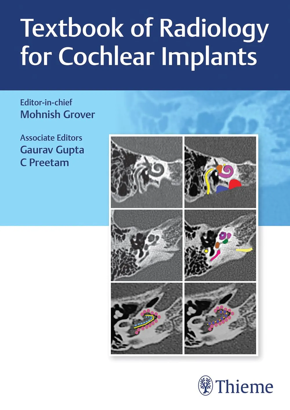 Textbook Of Radiology For Cochlear Implants | Hardcover