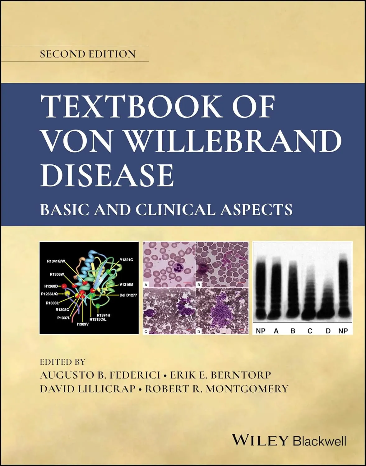 Textbook Of Von Willebrand Disease Basic And Clinical Aspects 2nd Editiond | Hardcover