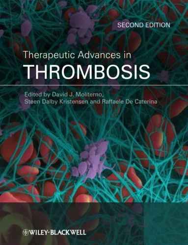 Therapeutic Advances in Thrombosis | 2nd Edition | Hardcover