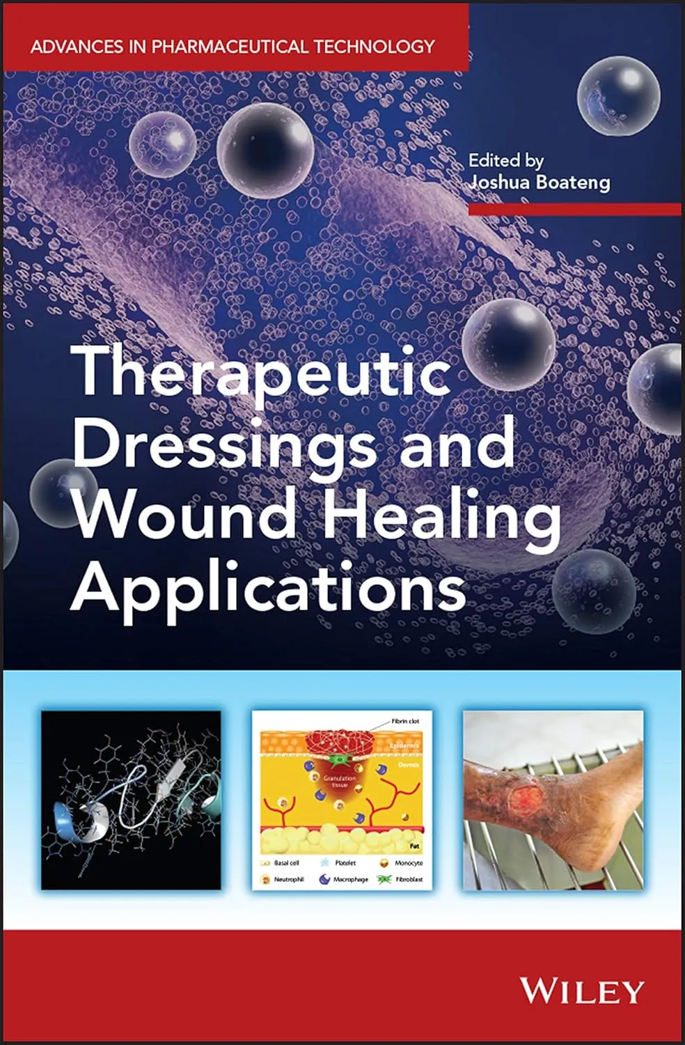 Therapeutic Dressings And Wound Healing Applications | Hardcover