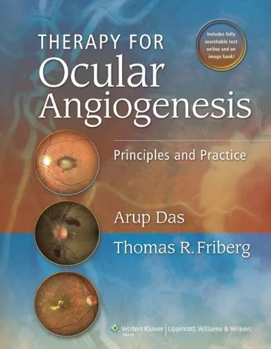 Therapy for Ocular Angiogenesis Principles and Practice | Hardcover