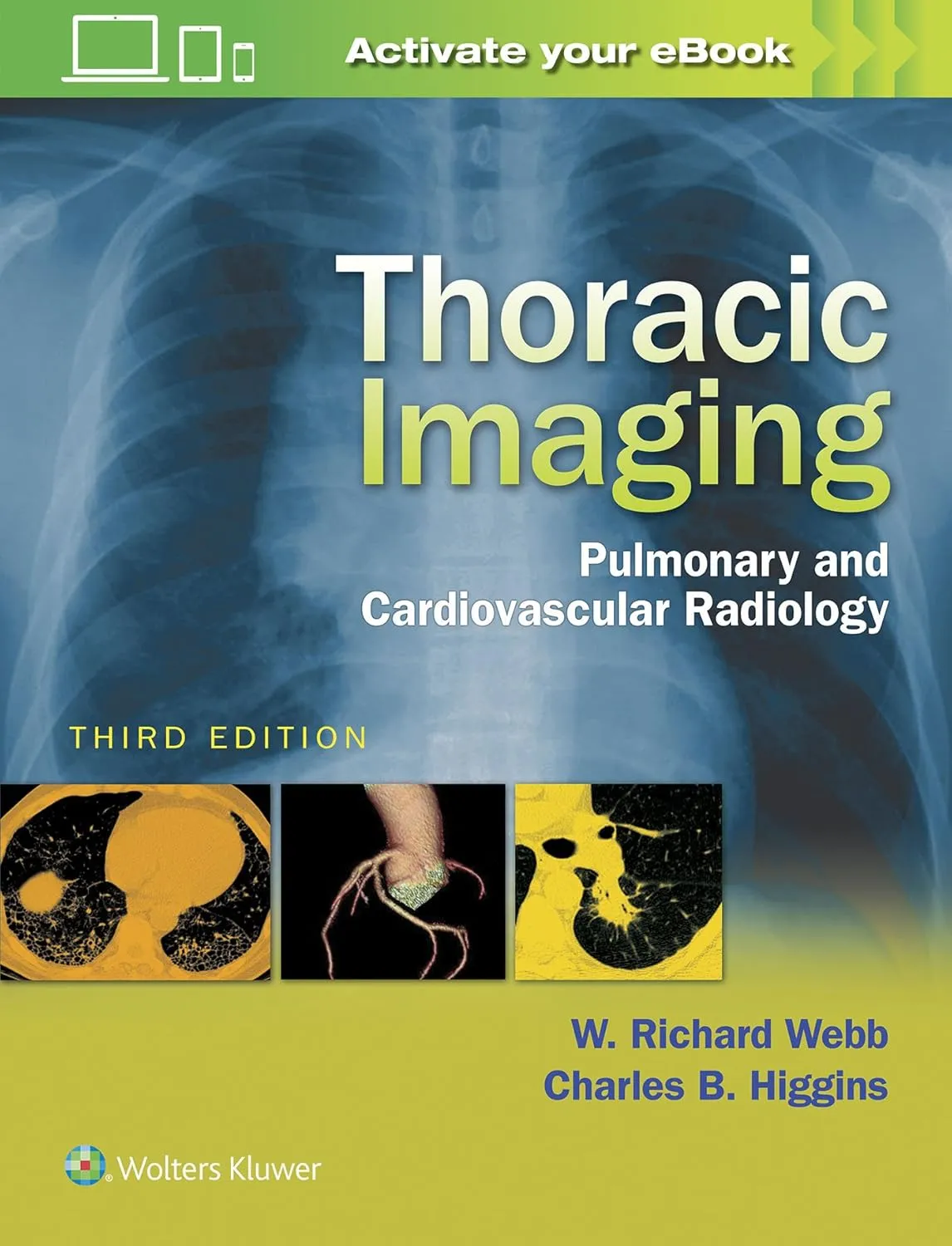 Thoracic Imaging Pulmonary and Cardiovascular Radiology | Third Edition | Hardcover